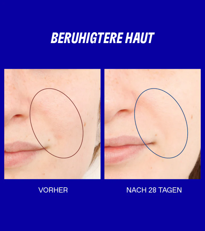 Smart Yoghurt Probiotisches Superserum - Image 6
